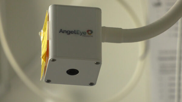 Angel eye camera showing a small camera lense.